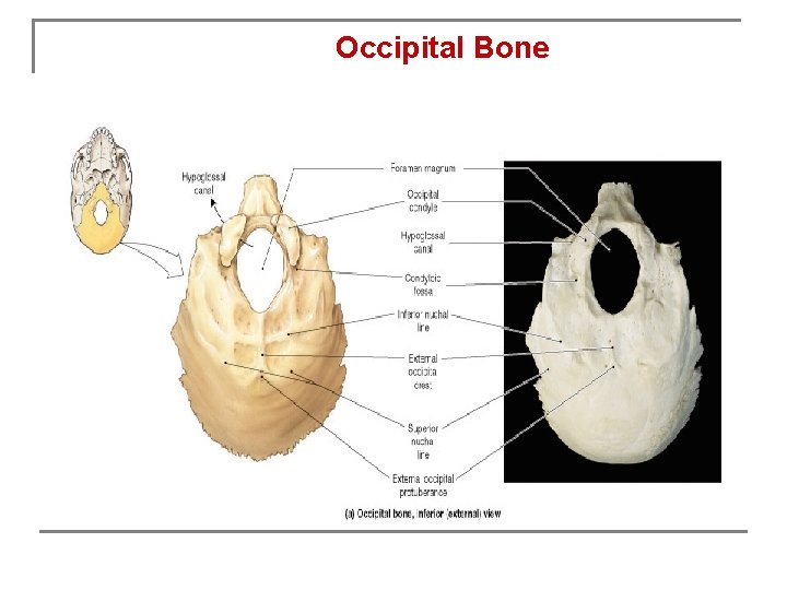 Occipital Bone 