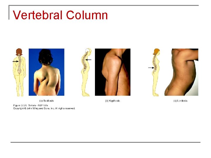 Vertebral Column 