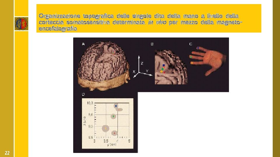 Organizzazione topografica delle singole dita della mano a livello della corteccia somatosensitiva determinata in