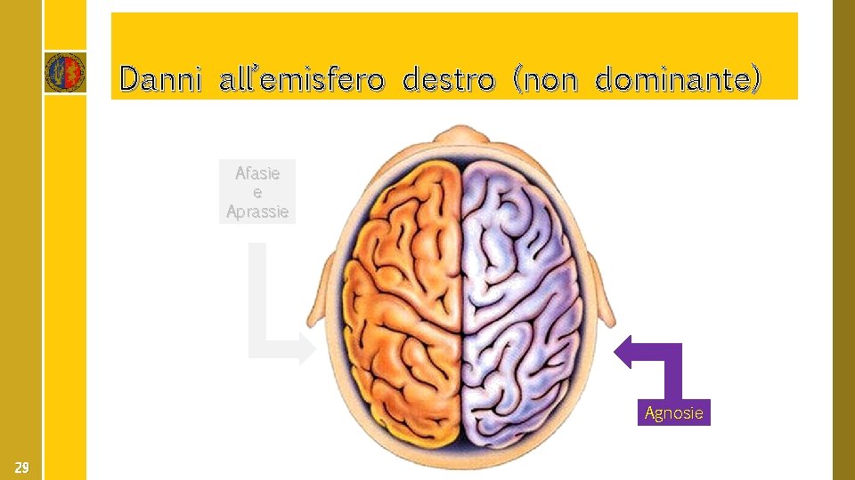 Danni all’emisfero destro (non dominante) Afasie e Aprassie Agnosie 29 