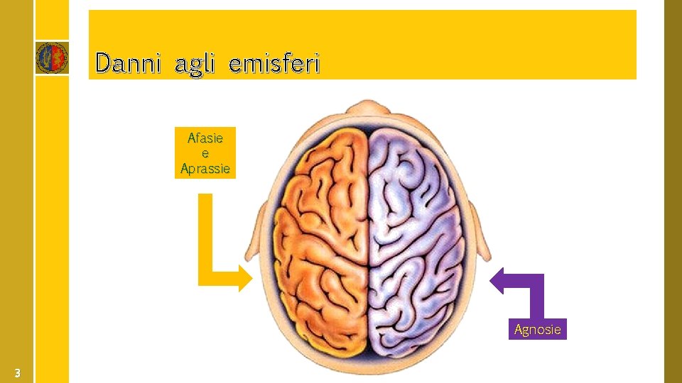 Danni agli emisferi Afasie e Aprassie Agnosie 3 