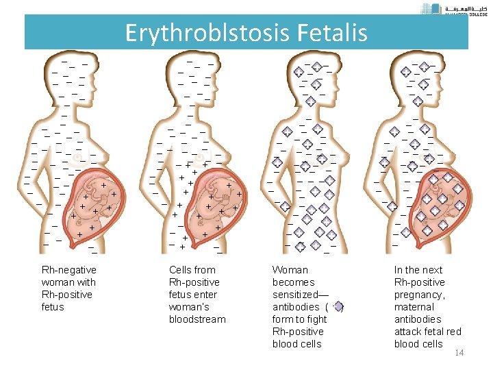 Erythroblstosis Fetalis –– – – – – –– – – – + – –