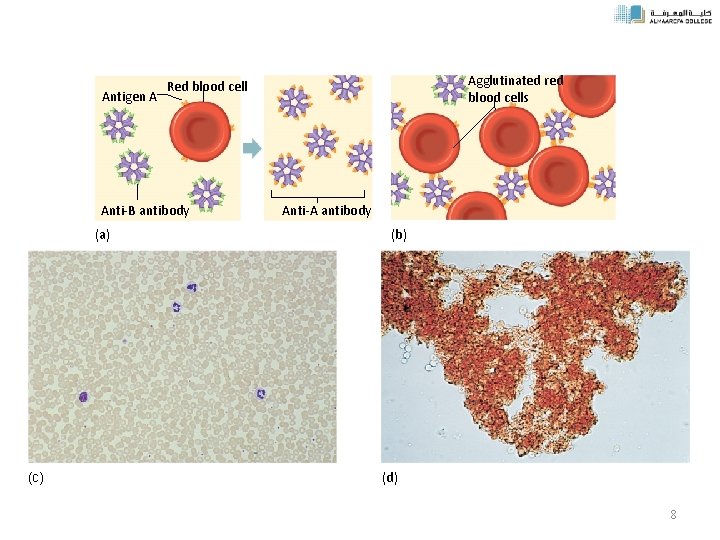 Antigen A Anti-B antibody (a) (c) Agglutinated red blood cells Red blood cell Anti-A