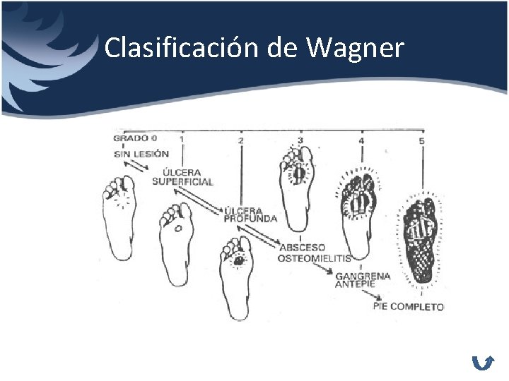 Clasificación de Wagner 