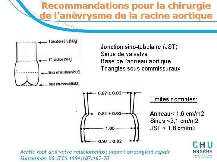 Recommandations pour la chirurgie de l’anévrysme de la racine aortique Jonction sino-tubulaire (JST) Sinus