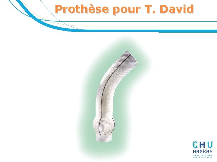 Prothèse pour T. David 27 