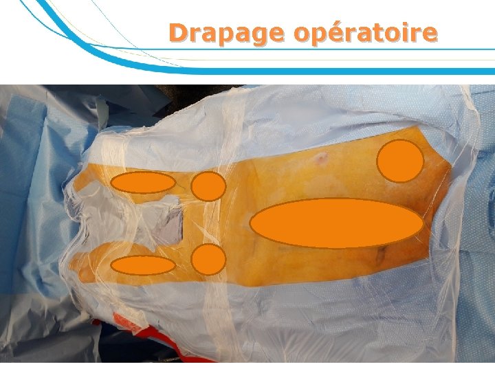 Drapage opératoire 31 