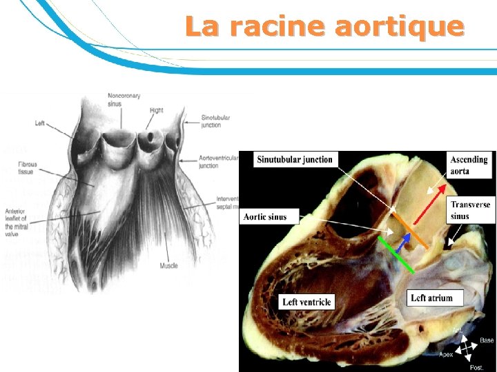 La racine aortique 7 
