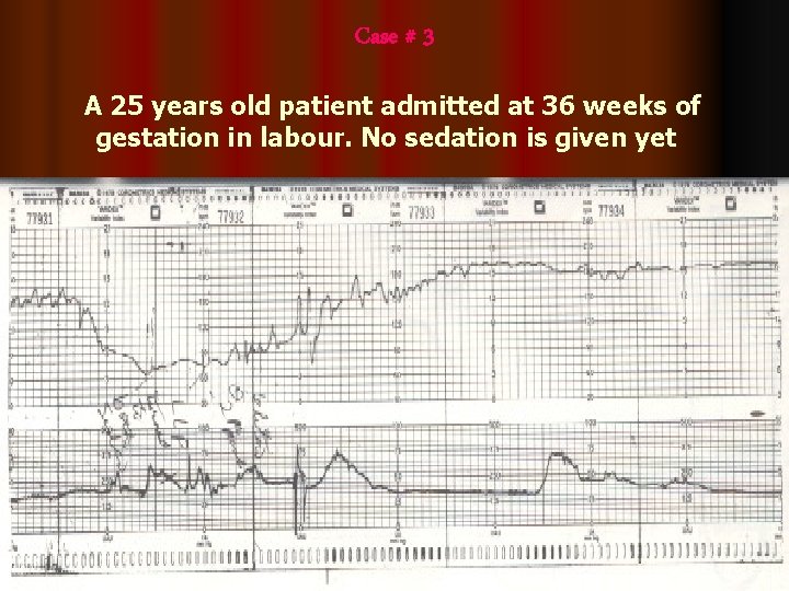 Case # 3 A 25 years old patient admitted at 36 weeks of gestation