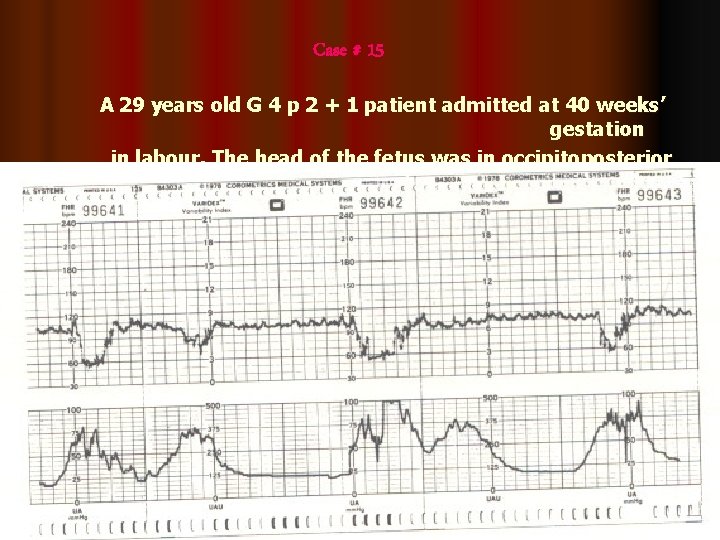 Case # 15 A 29 years old G 4 p 2 + 1 patient