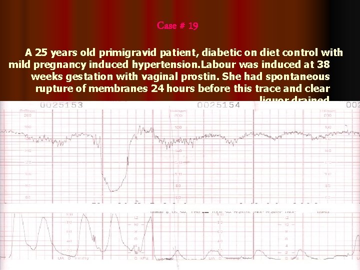 Case # 19 A 25 years old primigravid patient, diabetic on diet control with