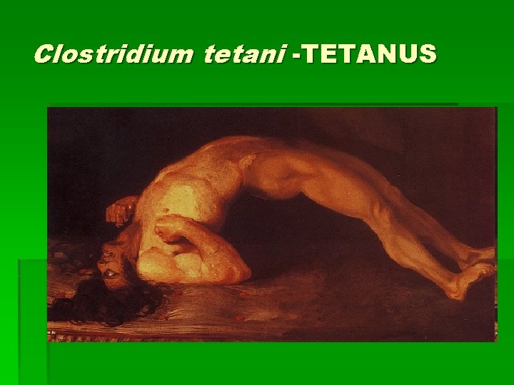 Clostridium tetani -TETANUS 