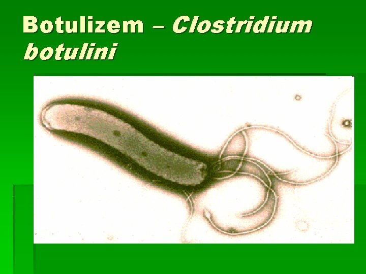 Botulizem – Clostridium botulini 