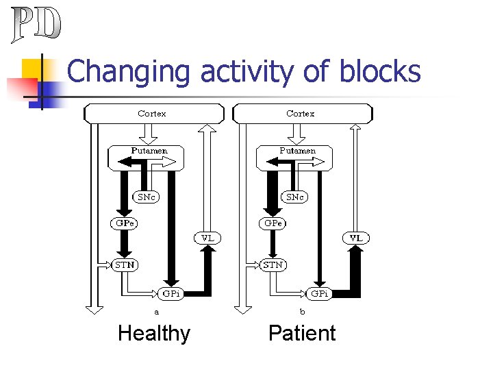 Changing activity of blocks Healthy Patient 