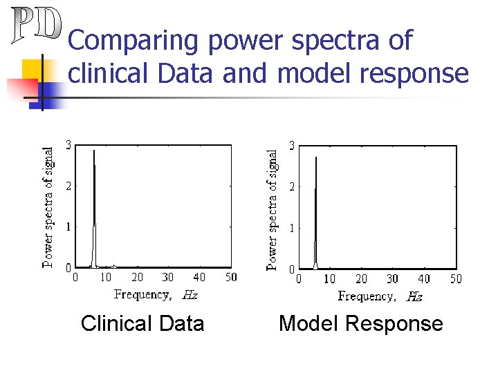 Comparing power spectra of clinical Data and model response Clinical Data Model Response 