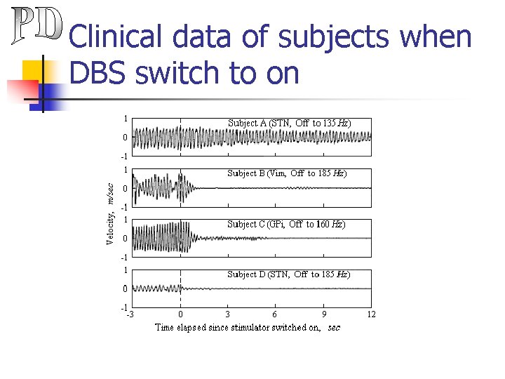 Clinical data of subjects when DBS switch to on 