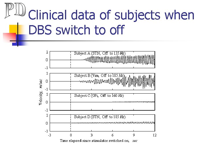 Clinical data of subjects when DBS switch to off 