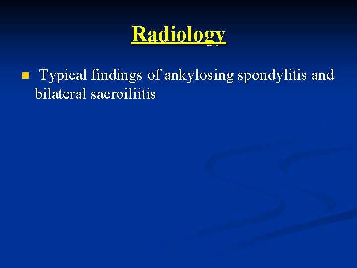 Radiology n Typical findings of ankylosing spondylitis and bilateral sacroiliitis 