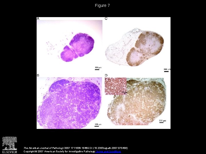 Figure 7 The American Journal of Pathology 2007 1711538 -1548 DOI: (10. 2353/ajpath. 2007.