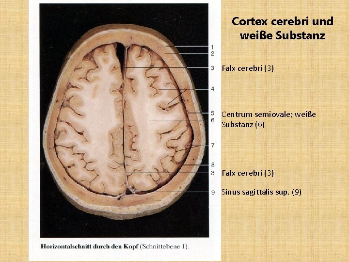 Cortex cerebri und weiße Substanz Falx cerebri (3) Centrum semiovale; weiße Substanz (6) Falx