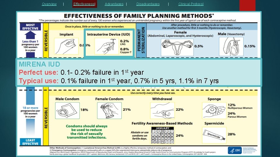 Overview | Effectiveness| Advantages | Disadvantages | Clinical Protocol MIRENA IUD Perfect use: 0.