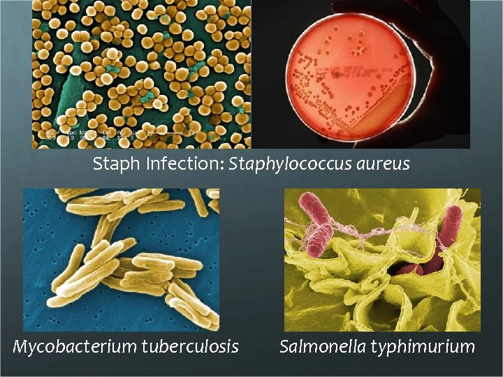 Staph Infection: Staphylococcus aureus Mycobacterium tuberculosis Salmonella typhimurium 