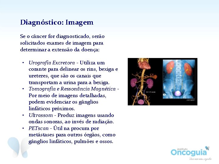 Diagnóstico: Imagem Se o câncer for diagnosticado, serão solicitados exames de imagem para determinar