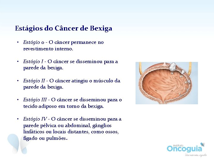 Estágios do Câncer de Bexiga • Estágio 0 - O câncer permanece no revestimento
