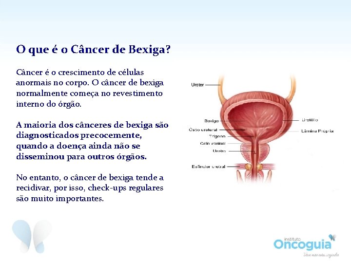 O que é o Câncer de Bexiga? Câncer é o crescimento de células anormais