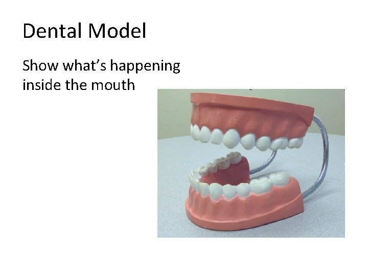 Dental Model Show what’s happening inside the mouth 