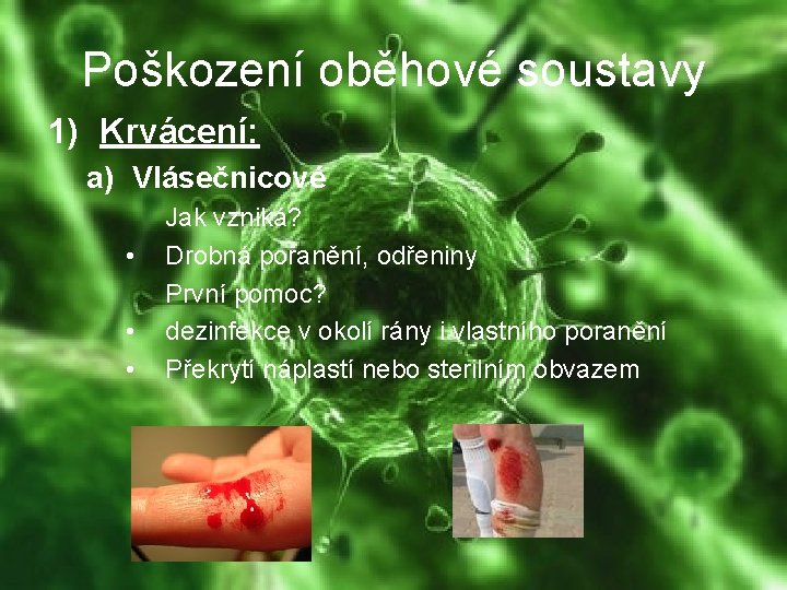 Poškození oběhové soustavy 1) Krvácení: a) Vlásečnicové • • • Jak vzniká? Drobná poranění,