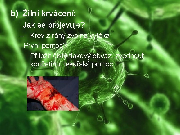 b) Žilní krvácení: Jak se projevuje? – Krev z rány zvolna vytéká První pomoc?