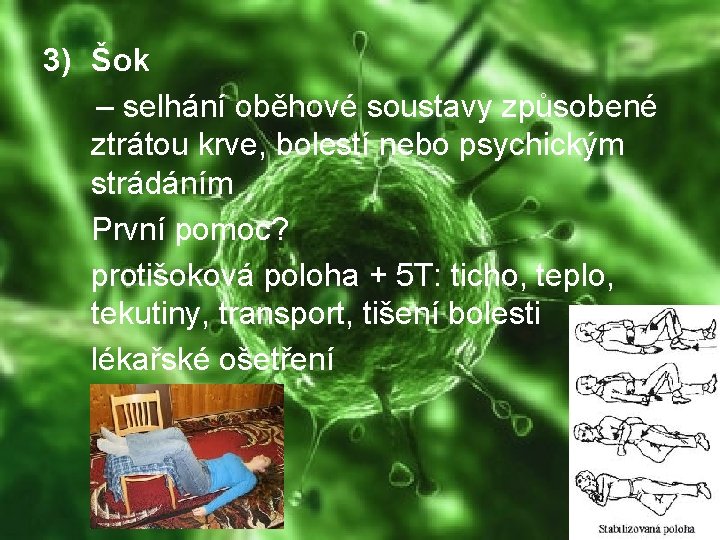 3) Šok – selhání oběhové soustavy způsobené ztrátou krve, bolestí nebo psychickým strádáním První