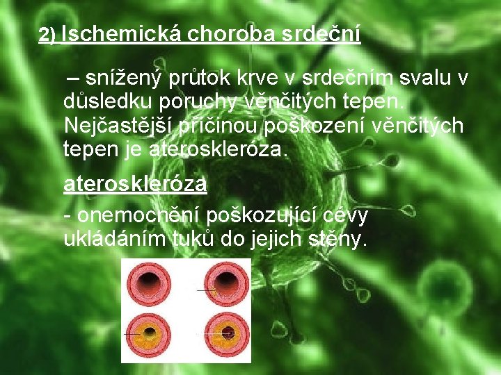 2) Ischemická choroba srdeční – snížený průtok krve v srdečním svalu v důsledku poruchy