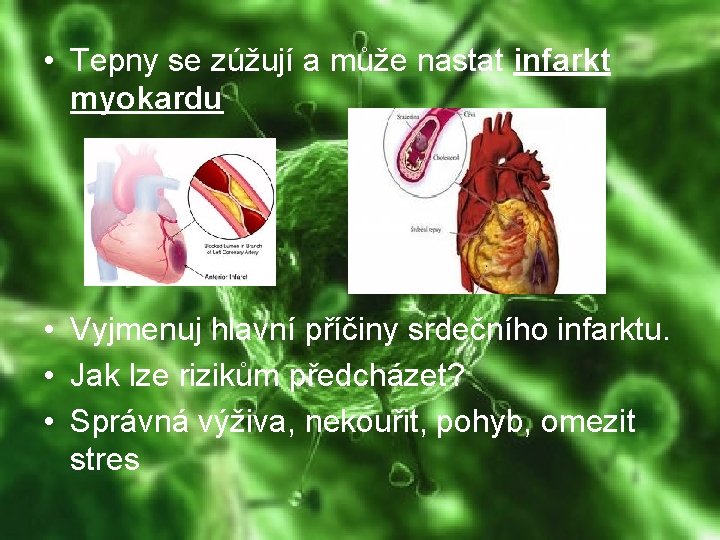  • Tepny se zúžují a může nastat infarkt myokardu • Vyjmenuj hlavní příčiny