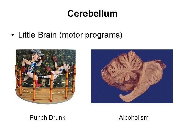 Cerebellum • Little Brain (motor programs) Punch Drunk Alcoholism 