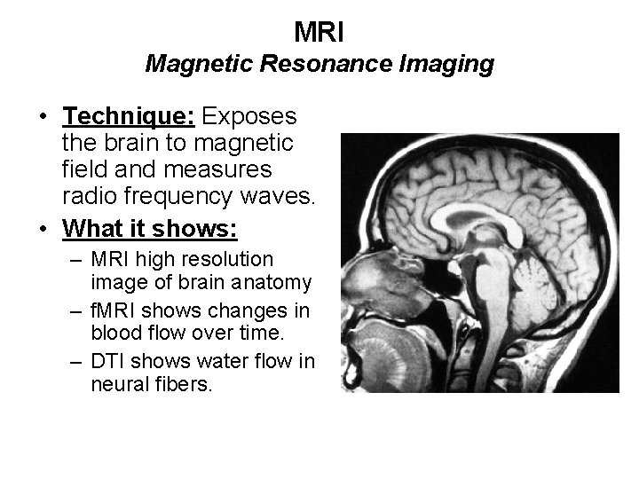 MRI Magnetic Resonance Imaging • Technique: Exposes the brain to magnetic field and measures
