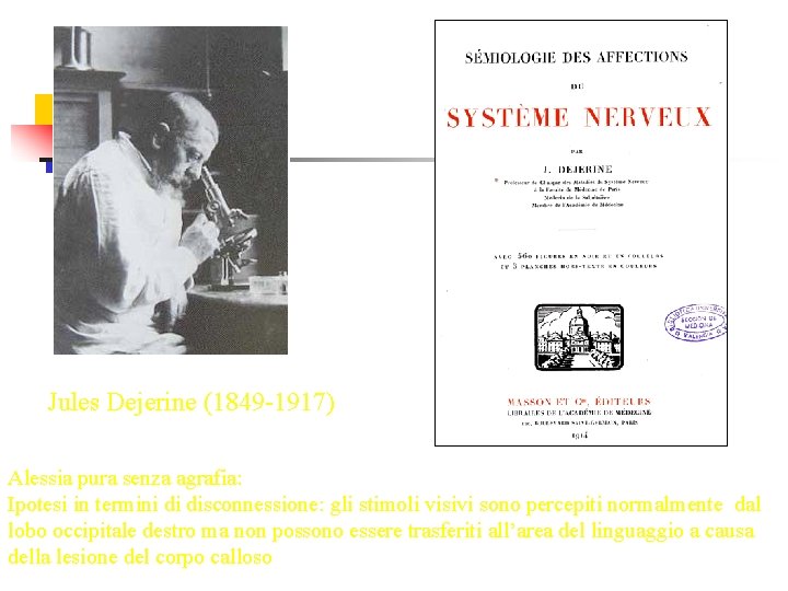 Jules Dejerine (1849 -1917) Alessia pura senza agrafia: Ipotesi in termini di disconnessione: gli