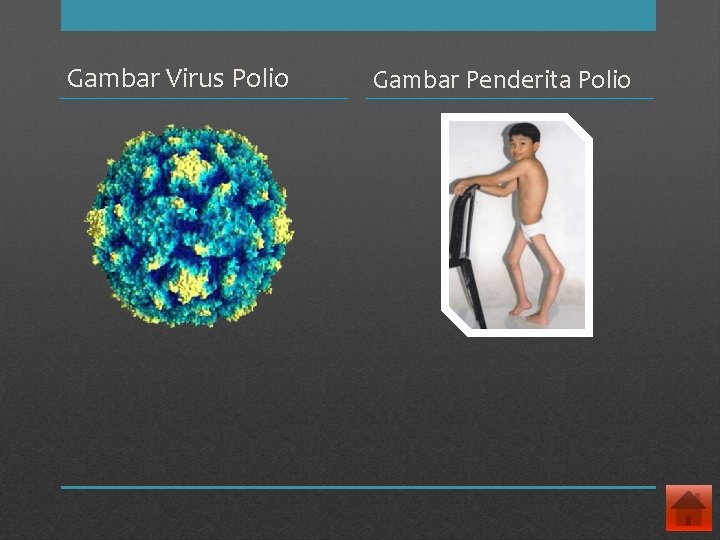 Gambar Virus Polio Gambar Penderita Polio 