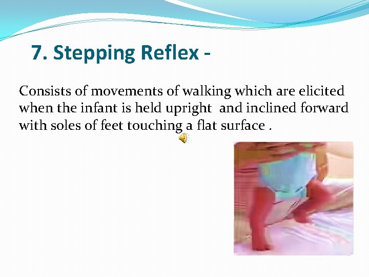 7. Stepping Reflex Consists of movements of walking which are elicited when the infant