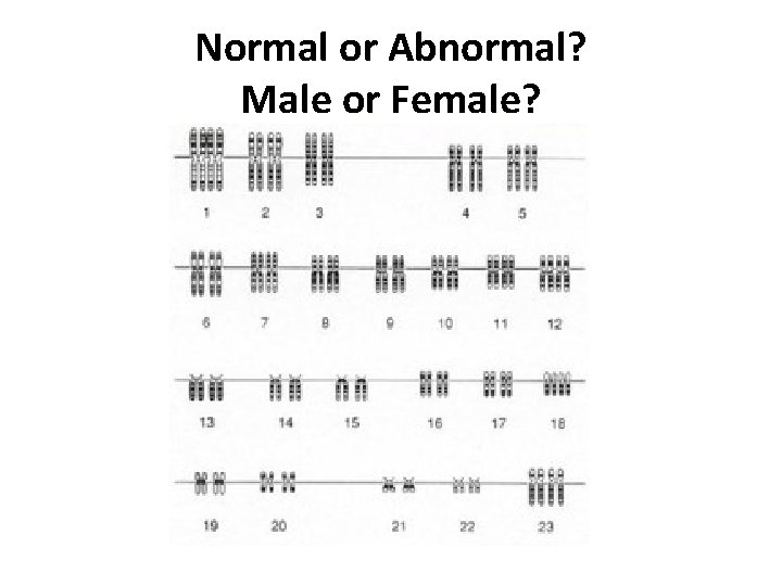 Normal or Abnormal? Male or Female? 