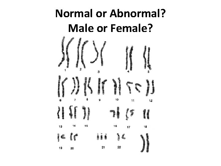 Normal or Abnormal? Male or Female? 