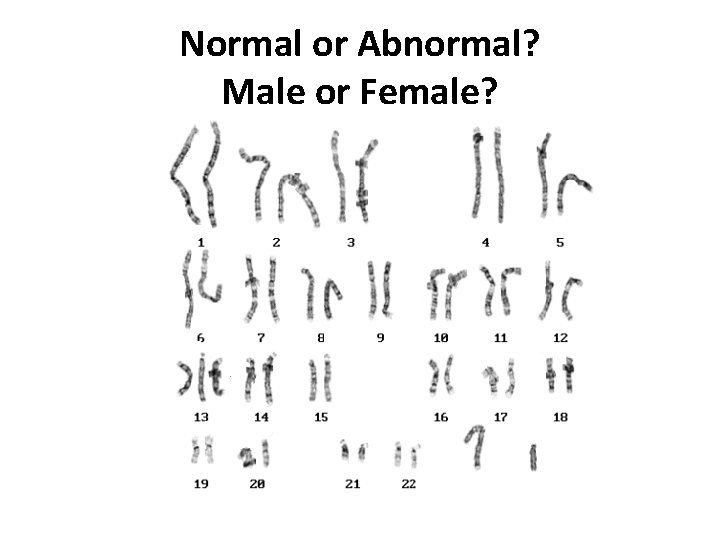 Normal or Abnormal? Male or Female? 