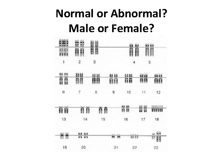 Normal or Abnormal? Male or Female? 