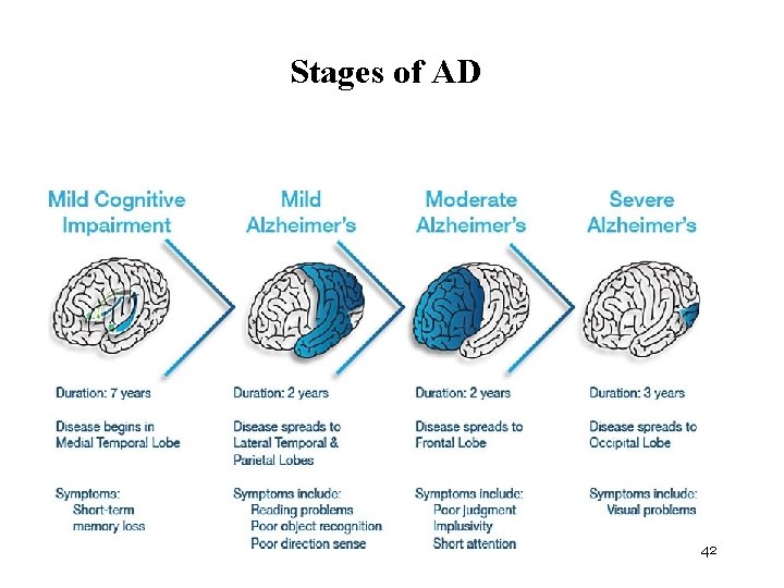 Stages of AD 42 