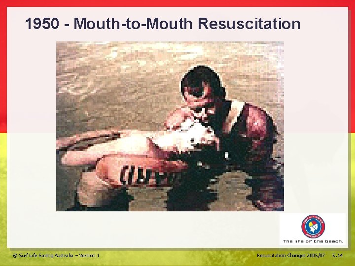 1950 - Mouth-to-Mouth Resuscitation © Surf Life Saving Australia – Version 1 Resuscitation Changes