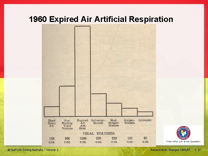 1960 Expired Air Artificial Respiration © Surf Life Saving Australia – Version 1 Resuscitation