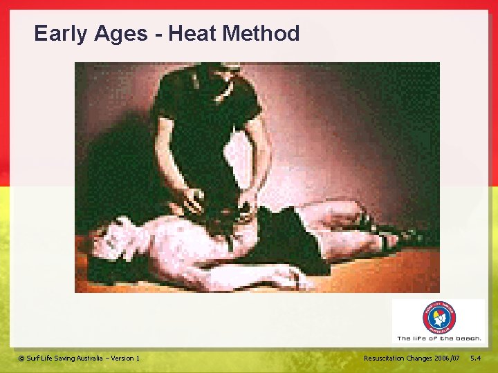 Early Ages - Heat Method © Surf Life Saving Australia – Version 1 Resuscitation