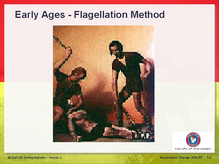 Early Ages - Flagellation Method © Surf Life Saving Australia – Version 1 Resuscitation
