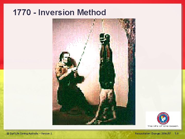 1770 - Inversion Method © Surf Life Saving Australia – Version 1 Resuscitation Changes